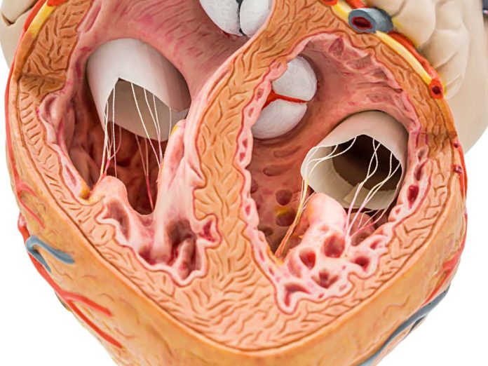 In-che-modo-il-calcio-nelle-arterie-coronarie-pu-predire