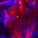 Bacteria-in-nerve-300x300
