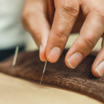 acupuncture-850