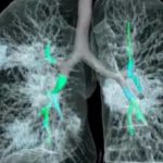 1584031673-polmoni-coronavirus