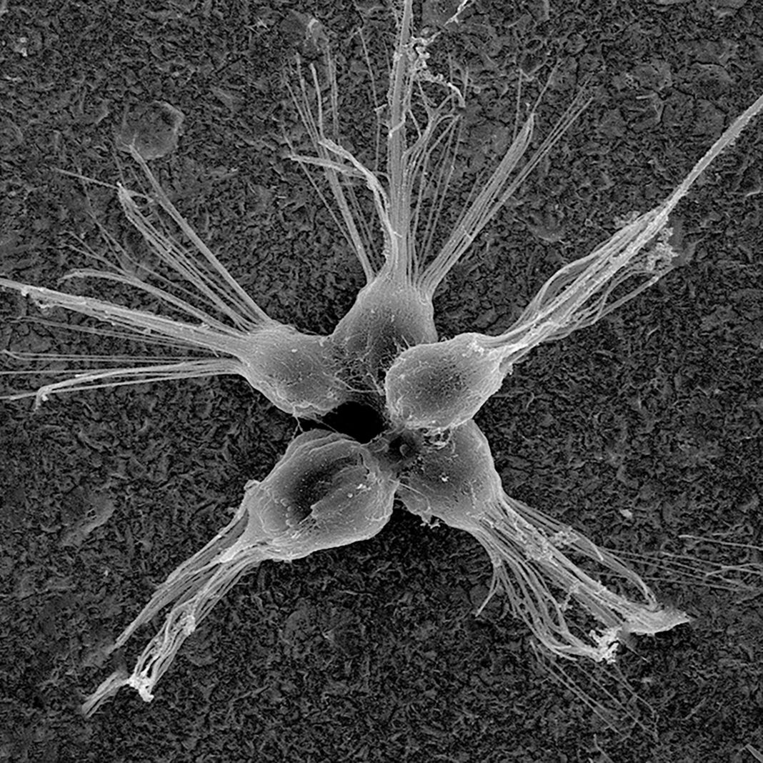 I Microbi Marini Unicellulari Potrebbero Abbattere I Virus MediMagazine