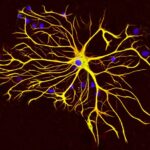 Astrocyte5-e1548789137576-1200x882