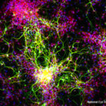 Retinal Ganglion Cells lg cr