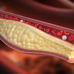 colesterolo-e-trigliceridi-1200-675