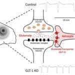 migraine-target-neurosncienews