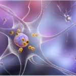 neuron-with-lewy-bodies-credit-katheryna-kon-shutterstock