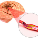 thinkstockphotos-609685498_thumb_720_480