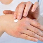 trattamento-della-dermatite-atopica-come-si-cura-preview-default