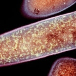 Clostridium difficile bacteria, TEM