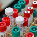 covid_test_francia_afp