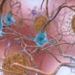 4955902_1529_alzheimer_vaccino_scoperta