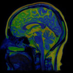 Brain MRI Scan of Healthy Male  ( Magnetic Resonance Imaging) High Resolution