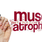 atrofia_muscolare_spinale