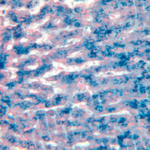 haemochromatosis-image_OG-700x350