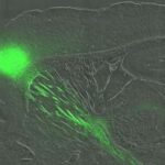 optogenetics