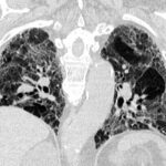 9c2084bb4cf42e6edfd98dc26db12abd_XL