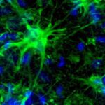 Astrocytes (green) + all nuclei (blue) in MS Hippocampus_0