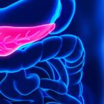 Cosa-dovresti-sapere-sul-cancro-del-pancreas