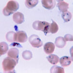 Plasmodium