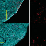 Ringel-T-Cells-Obese-vs-Nonobese_2500-900x600