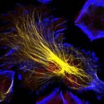 Scoperti-nuovi-dettagli-sui-meccanismi-molecolari-del-neuroblastoma