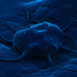 cancercell