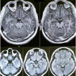 head14006-fig-0001-m