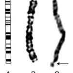images_genetica_molecolare_ideogramma_cromosoma_x