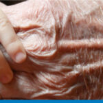 perchè-la-pelle-invecchia-ok