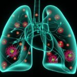 polmonite-panoramica-950x684 (1)