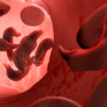 Sickle cell anemia, artwork