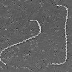 Leptospira_interrogans_strain_RGA_01-1