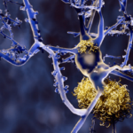 img-0_neuroni-alzheimer