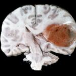 9C602FF5-3834-46F7-960E5E976066E9F9_source