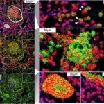 Immune-Cells-Surround-Infected-Lung-Cells-400x312