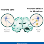 content_4DemenzaSenile-Infografica