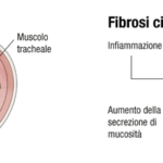 fibrosi_cistica