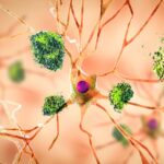 morbo-di-alzheimer-cause_900x760