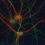 neuronal_cell_culture_with_dendritic_marker_in_red_and_neurofilament_axon_in_green