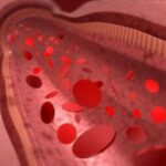 trombosi-cerebrale-cause-sintomi-conseguenze-1200x900