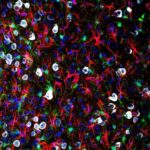 Microglia-Wellcome-645x645