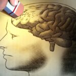 alzheimer
