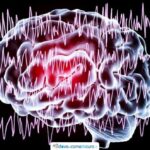 large_Template-epilessia