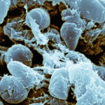 SEM, image of Yersinia pestis bacteria