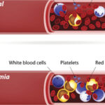 thinkstockphotos-530264507_thumb_720_480