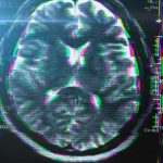 Brain-Glitch-Stress-Disorder-Concept-777x518 (1)