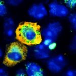 SARS-CoV-2-Infected-Monkey-Kidney-Cells-777x518