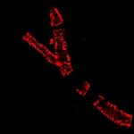 Small-Blood-Vessel-Brain