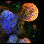 biomarker-predicts-bow