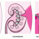 KID_kidney_injuries_it